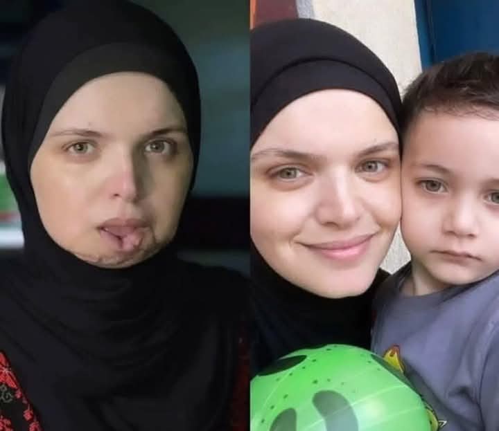 “Yaralara rağmen susturulamayan sesim ben.”